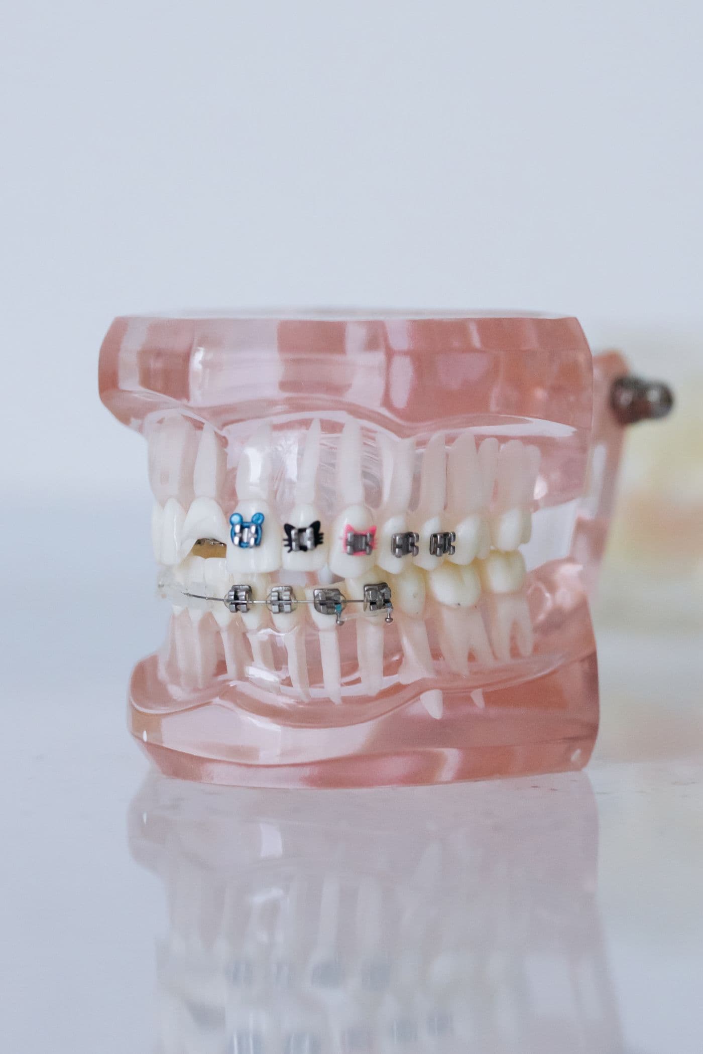 A natural-looking dental prosthetic