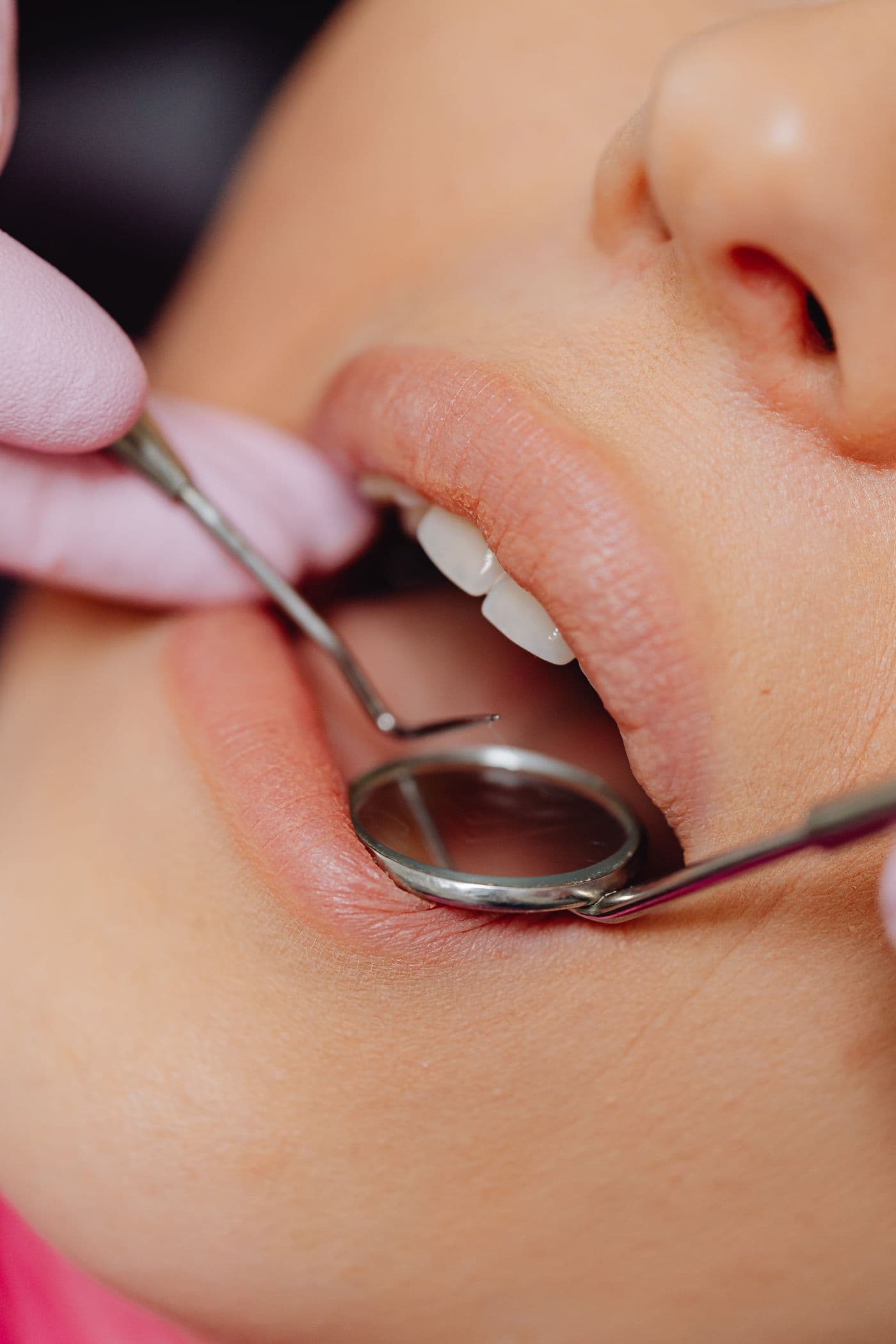 Close-up dental examination